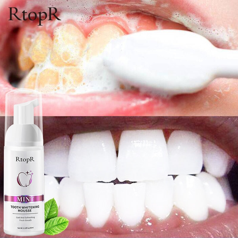 Mousse Blanqueador Dental