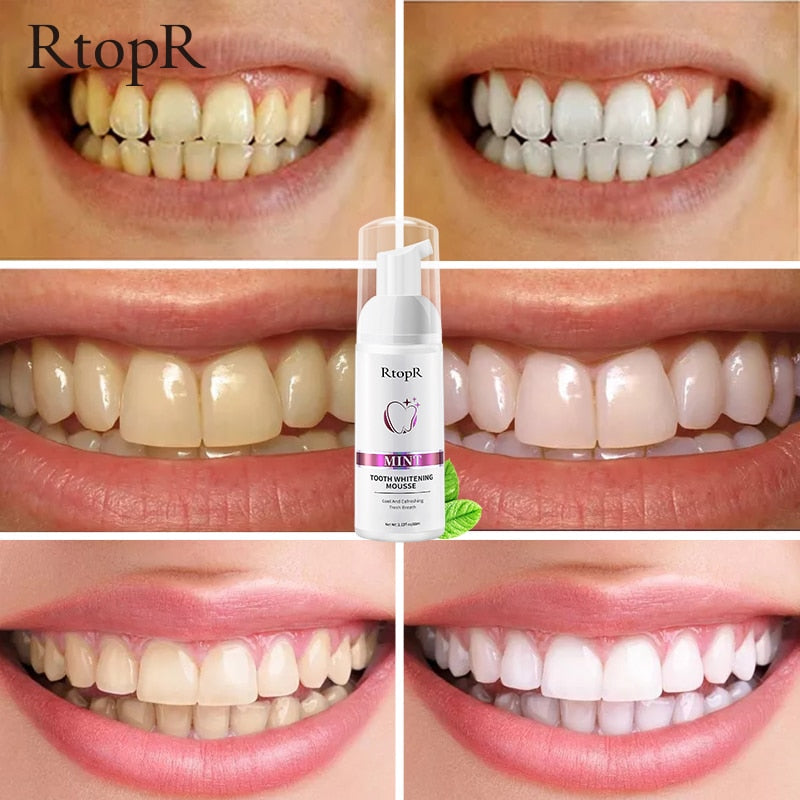 Mousse Blanqueador Dental