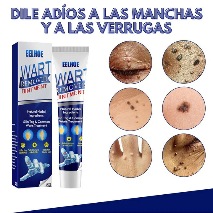 Crema para Eliminar Verrugas – Solución Natural y Efectiva para una Piel Impecable