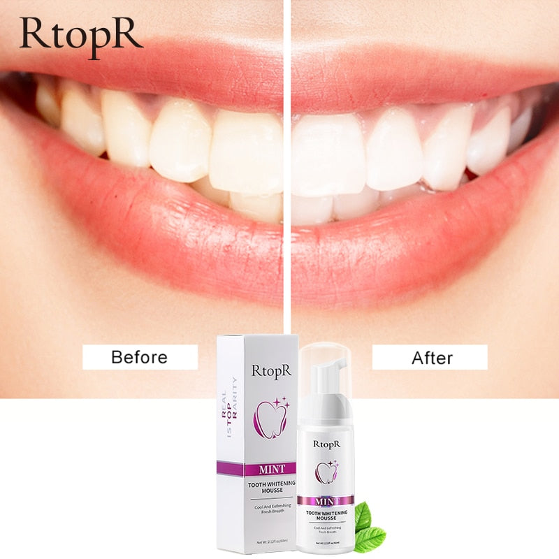 Mousse Blanqueador Dental