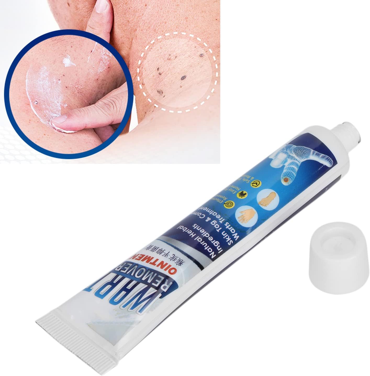 Crema para Eliminar Verrugas – Solución Natural y Efectiva para una Piel Impecable
