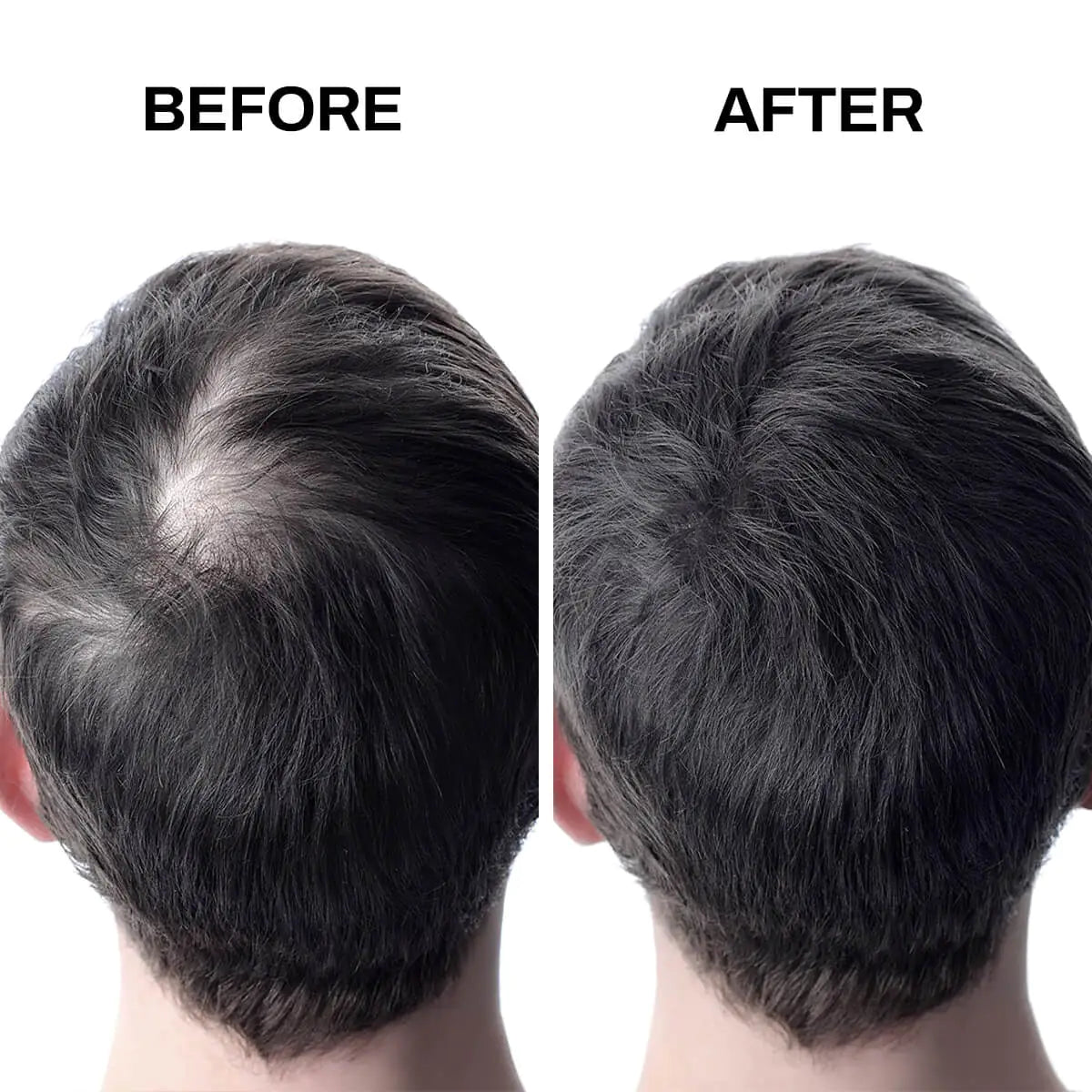 Fibras Capilares para Cabello Escaso – Volumen Instantáneo, Confianza Renovada