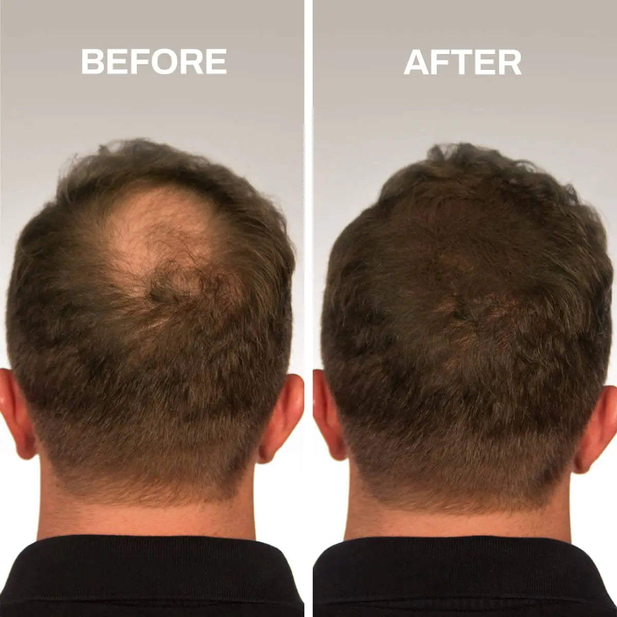 Fibras Capilares para Cabello Escaso – Volumen Instantáneo, Confianza Renovada